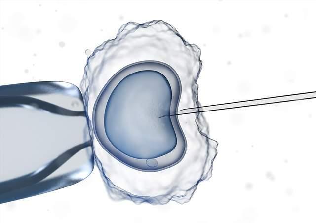 生殖医学中心开设广州高薪卵子捐赠项目